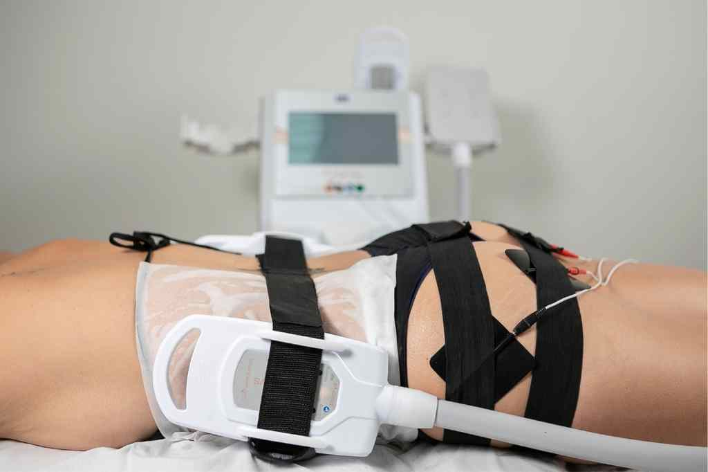 Aplicadores de criolipólise posicionados na região abdominal durante um tratamento